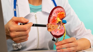 Jangan Abaikan Ginjal Saat Puasa, Ini Rahasia Detoksifikasi yang Benar