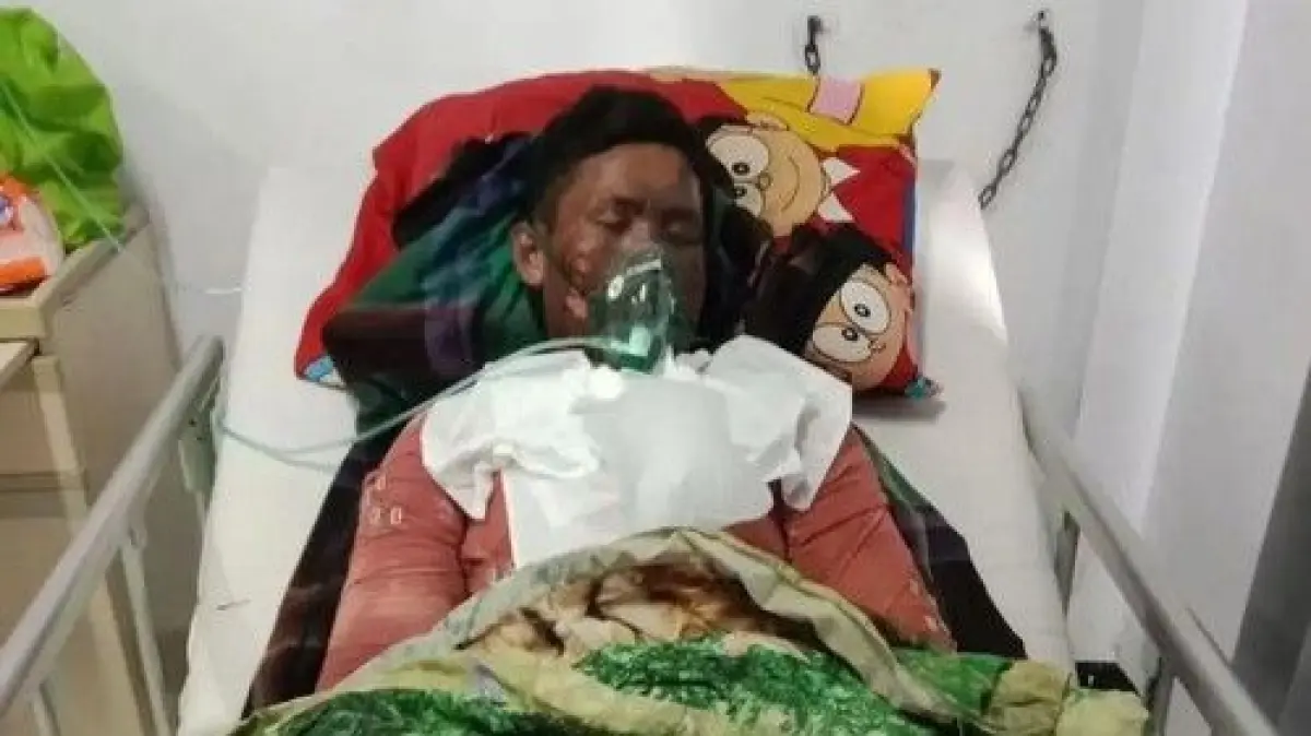 Foto: Muhammad Ikbal meninggal dunia saat dirawat di RSUD NTB, Mataram, pada Minggu (28/2/2026). (Istimewa)